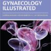 Gynaecology Illustrated, 6e 6th Edition