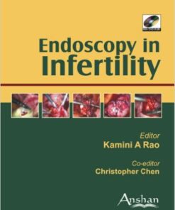 Endoscopy in Infertility