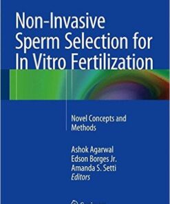 Non-Invasive Sperm Selection for In Vitro Fertilization: Novel Concepts and Methods 2015th Edition