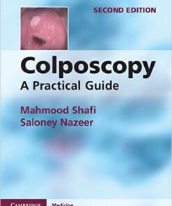 Colposcopy: A Practical Guide 2nd Edition