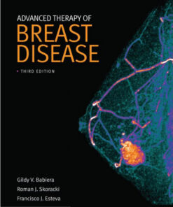 Advanced Therapy of Breast Disease, 3e 3rd Edition