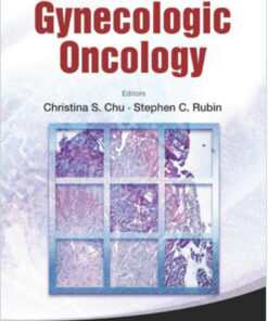 Manual of Gynecologic Oncology 1st Edition