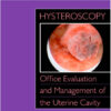 Hysteroscopy: Office Evaluation and Management of the Uterine Cavity: Text  1e