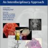 Endonasal Endoscopic Surgery of Skull Base Tumors: An Interdisciplinary Approach 1st Edition