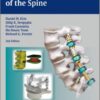 Dynamic Reconstruction of the Spine 1E