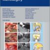 Atlas of Acoustic Neurinoma Microsurgery 2nd edition