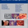 Microsurgery of Skull Base Paragangliomas 1st edition