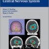 Ebook Tumors of the Pediatric Central Nervous System 2nd edition