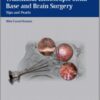 Transnasal Endoscopic Skull Base and Brain Surgery: Tips and Pearls 1st edition