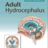 Adult Hydrocephalus 1st Edition