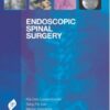Endoscopic Spinal Surgery 1st Edition