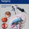 Neuroendoscopic Surgery 1st Edition