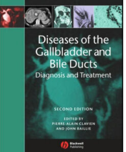 Diseases of the Gallbladder and Bile Ducts: Diagnosis and Treatment, 2nd Edition