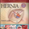 Master Techniques in Surgery: Hernia