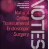 Natural Orifice Translumenal Endoscopic Surgery: Textbook and Video Atlas