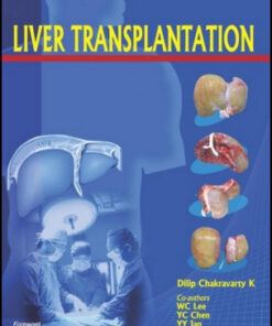 Liver Transplantation