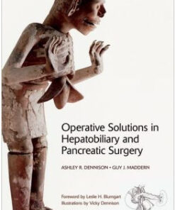 Operative Solutions in Hepatobiliary and Pancreatic Surgery