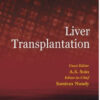 Liver Transplantation – ECAB