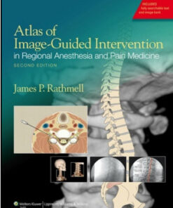 Atlas of Image-Guided Intervention in Regional Anesthesia and Pain Medicine, 2nd Edition