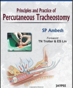 Principles and Practice of Percutaneous Tracheostomy