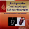 Perioperative Transesophageal Echocardiography: A Companion to Kaplan’s Cardiac Anesthesia