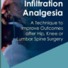 Local Infiltration Analgesia: A Technique to Improve Outcomes after Hip, Knee or Lumbar Spine Surgery