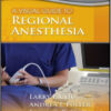 Visual Guide to Regional Anesthesia: Point of Care Essentials