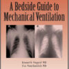 A Bedside Guide To Mechanical Ventilation