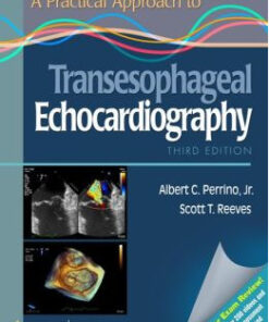 A Practical Approach to Transesophageal Echocardiography, 3rd Edition