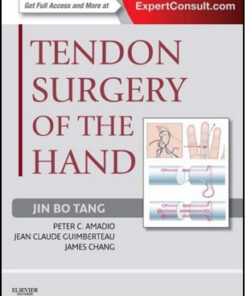 Tendon Surgery of the Hand Expert Consult – Online and Print
