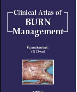 Clinical Atlas of Burn Management