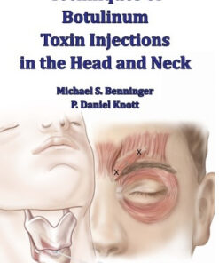 Techniques of Botulinum Toxin Injections in the Head and Neck