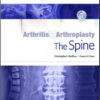 Arthritis and Arthroplasty: The Spine: 1e Edition