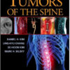 Tumors of the Spine