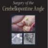 Surgery of the Cerebellopontine Angle 1st Edition