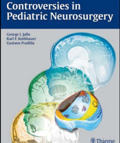 Controversies in Pediatric Neurosurgery