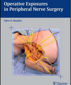 Operative Exposures in Peripheral Nerve Surgery