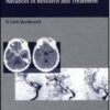 Cerebral Vasospasm: Advances in Research and Treatment