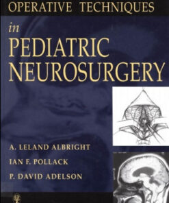 Operative Techniques in Pediatric Neurosurgery
