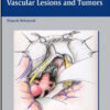 Neurosurgery of Complex Vascular Lesions and Tumors