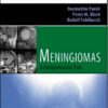 Meningiomas: A Comprehensive Text Expert Consult – Online and Print