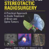 Image-Guided Hypofractionated Stereotactic Radiosurgery : A Practical Approach to Guide Treatment of Brain and Spine Tumors