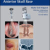 Endoscopic Surgery of the Paranasal Sinuses and Anterior Skull Base, 2nd Edition