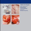 Restitutional Surgery of the Ear and Temporal Bone