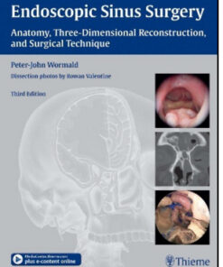 Endoscopic Sinus Surgery: Anatomy, Three-Dimensional Reconstruction, and Surgical Technique, 3rd Edition