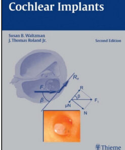 Cochlear Implants, 2nd Edition