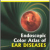 Endoscopic Color Atlas of Ear Diseases