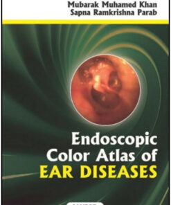 Endoscopic Color Atlas of Ear Diseases