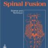 Spinal Fusion: Science and Technique