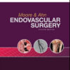 Endovascular Surgery, 4th Edition